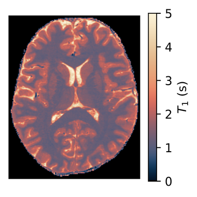 quantitative T1 map of brain