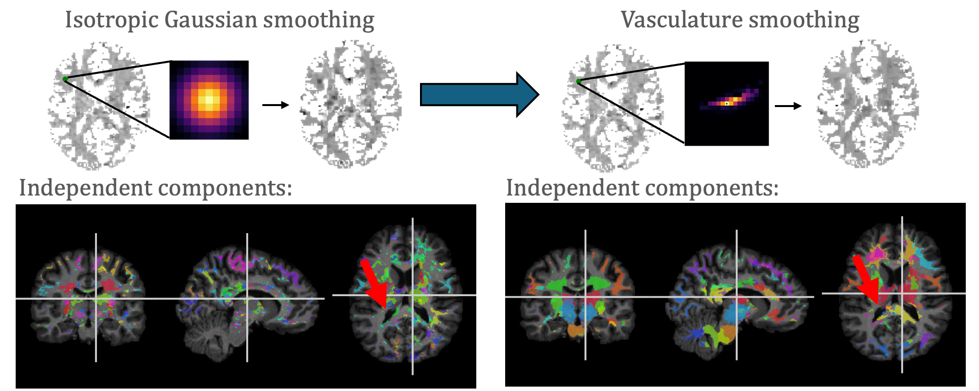 Vasculature smoothing overview